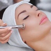 Diamond dermabrasion at YAS Cosmetology