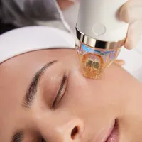 Micro needling at YAS Cosmetology